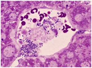 – 200808bac salmonella