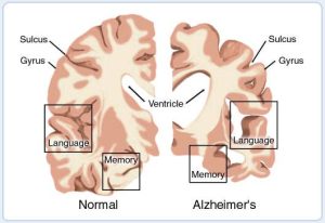 – 201102brain cross section border