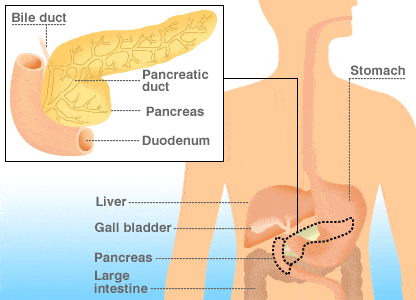 – 201103pancreatic cancer