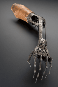 – 201106victorian artificial arm1