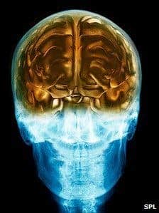 – 20110955456808 c0096784 healthy brain in the skull 3d mri scan spl