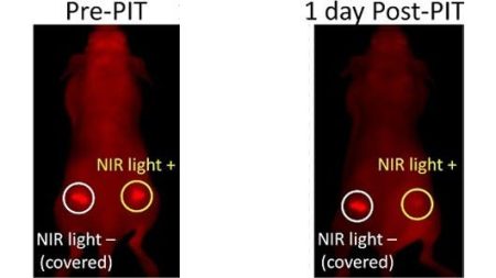 – 201111light therapy cancer