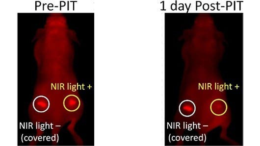 – 201111light therapy cancer