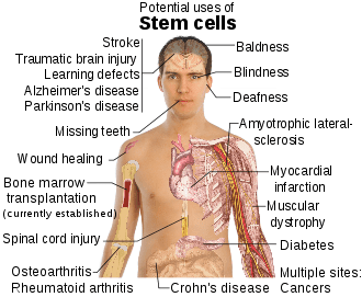 – 201111stem cell