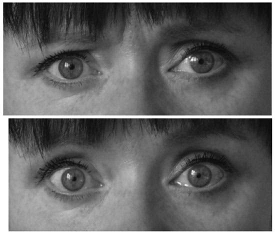 Normal eyes (above), and and glazed eyes (below). (Credit: Academy of Finland)