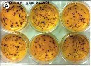 Pigmented epithelial cells were grown from embryonic stem cells prior to injection. 