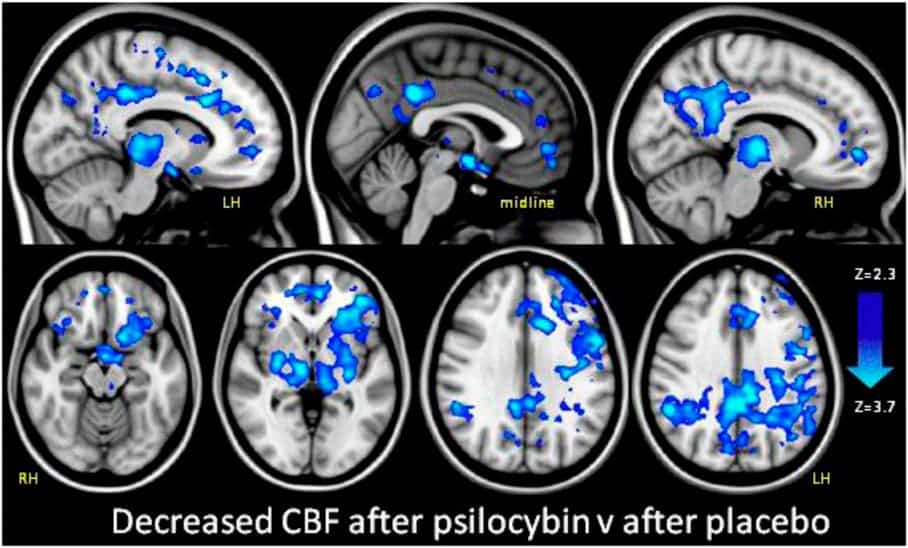 Decreased cerebral blood flow (CBF) after psilocybin imaged by fMRI