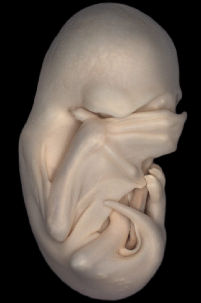 Mastiff Bat Embryo