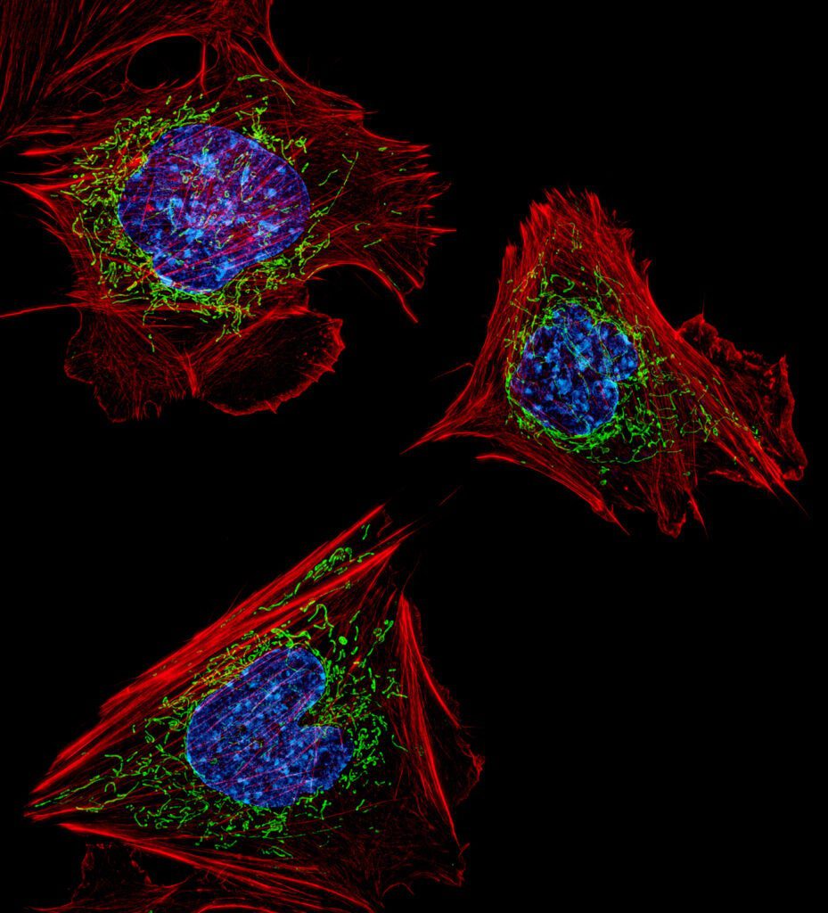 Mouse Embryonic Fibroblasts