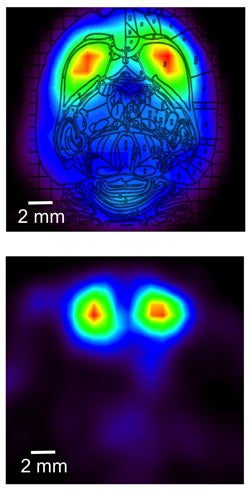 PET scans of a rat's brain made with the RatCAP scanner.