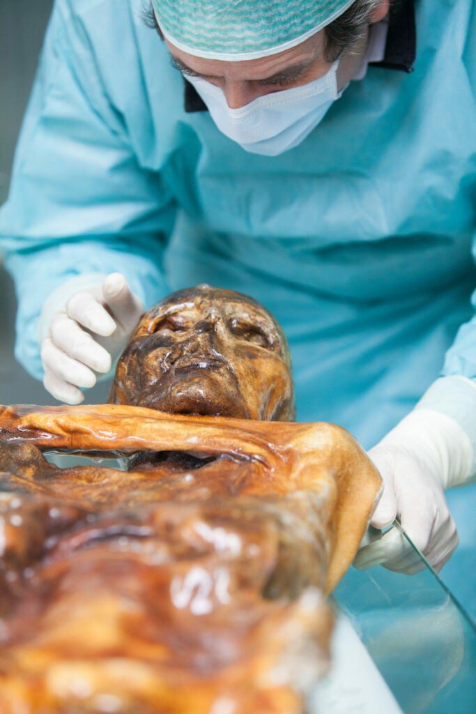 Doctor examining The Iceman