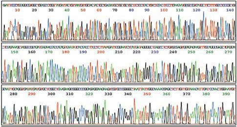 <strong>When Was it Predicted:</strong> Amidst much hoopla, the US government and Craig Venter's Celera Corporation raced to publish a complete map of the human genome. In February 2001 both projects announced that they had completed a rough draft of the human genome, ushering in a new age of genetic medicine and health. Except not. <strong>What's the Holdup:</strong> While doctors can now test whether or not a patient is predisposed to a number of diseases, no one has had a faulty copy of a gene fixed or otherwise of anything as a result of genetics. <em>[At left: Genome sequence trace.]</em>