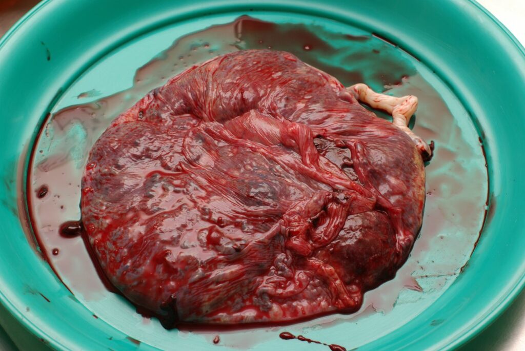 placenta