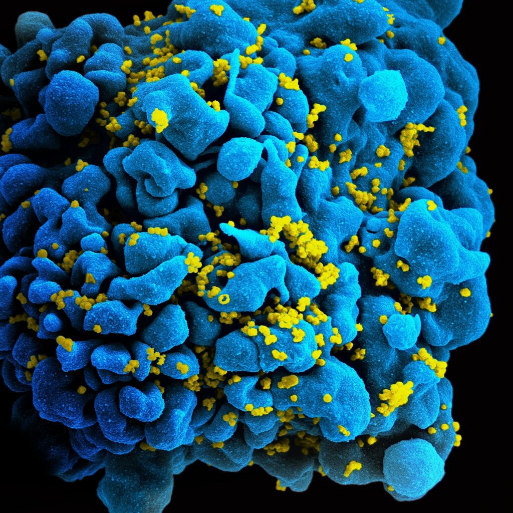 HIV infected cell