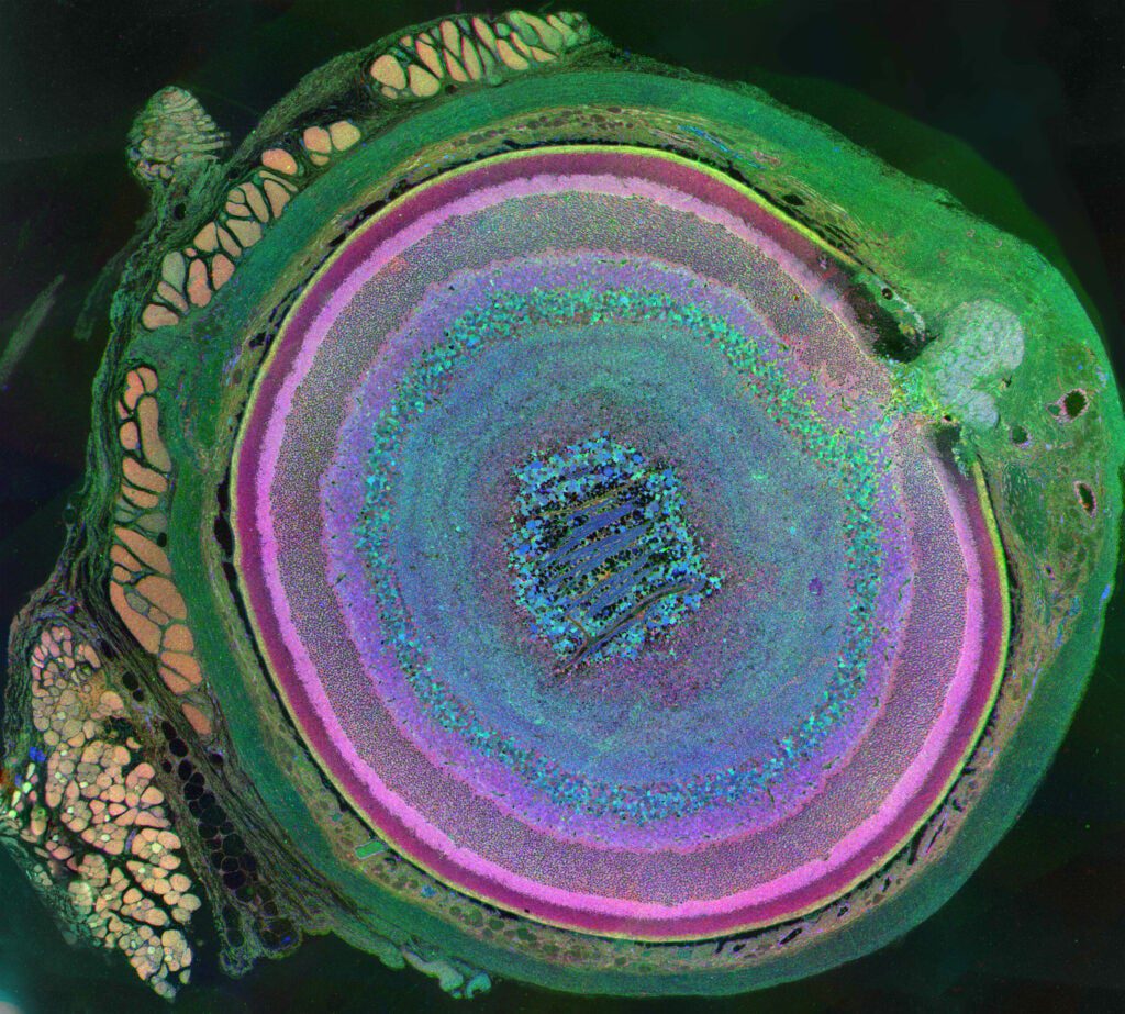 This is a metabolic snapshot of the diversity of cells in a mouse eye, and the first-place winner for photography in the 2011 International Science and Engineering Visualization Challenge. The image was derived using a technique called computational molecular phenotyping (CMP). The optic nerve head can be seen in the upper right portion of the image with the rectus muscles (red/gold) attaching to the sclera (green) on the upper left portion, and an oblique muscle in the lower left. Concentric rings of retinal layers are then represented from the sclera through to the vascular choroid to the optic fiber layer.