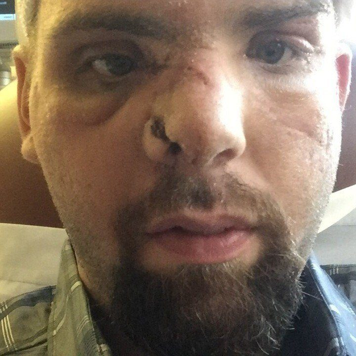 Dad had his face ripped off by bear in brutal attack