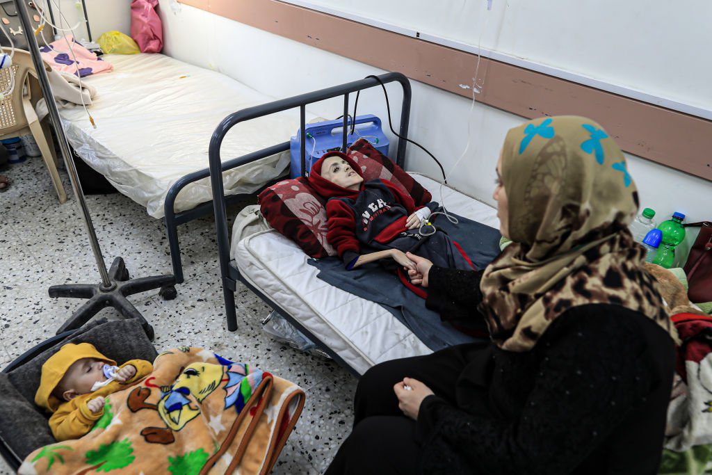 RAFAH, GAZA - FEBRUARY 28: Yezen Al-Kfarna, a 10 year old Palestinian boy who suffers malnourishment due to the ongoing Israeli blockade receives medical treatment with limited resources at Abu Yusuf al-Najjar Hospital in Rafah, Gaza on February 28, 2024. Palestinians are struggling with hunger and malnutrition due to the blockade preventing humanitarian aid from entering. Many Gazan children are in danger of death due to malnutrition. (Photo by Jehad Alshrafi/Anadolu via Getty Images)