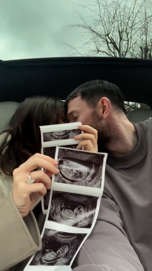 Megan McKenna and Oliver Burke announcing their pregnancy